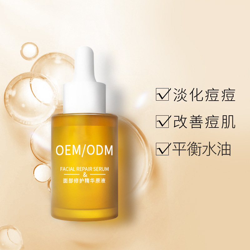 西咸新区_祛痘精华原液OEM